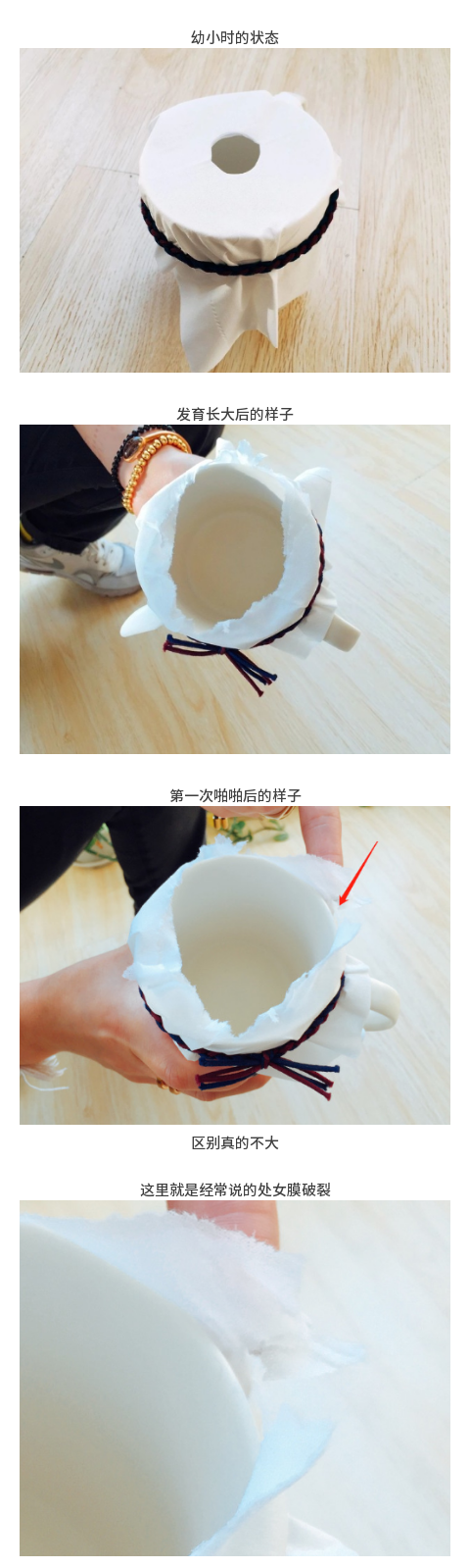 简单科普:处女膜到底是不是个“膜”? 简单科普:处女膜到底是不是个“膜”?